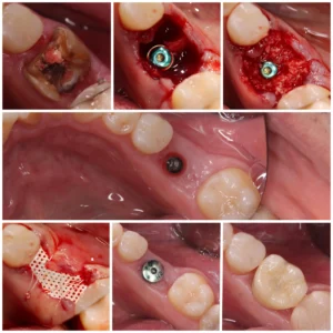 Advance Dental Training