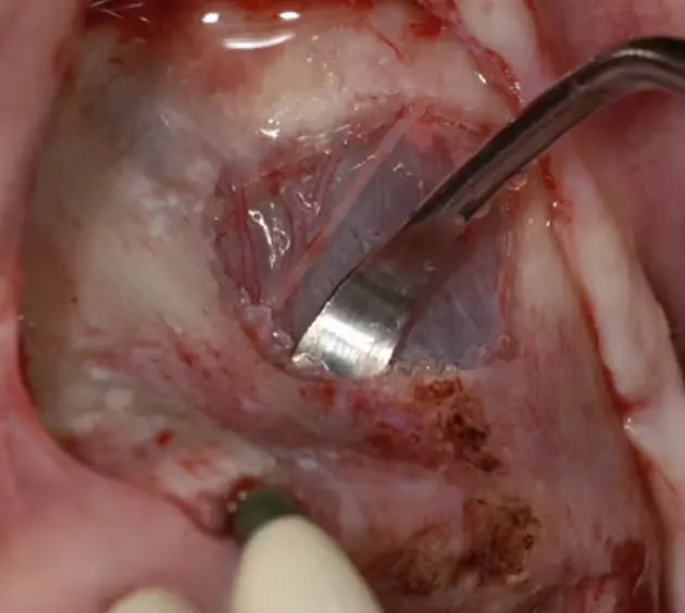 Home Hands-On Dental Workshops